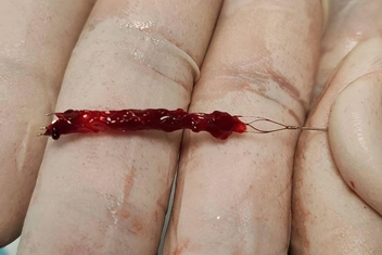 Источник: Департамент здравоохранения Тюменской области