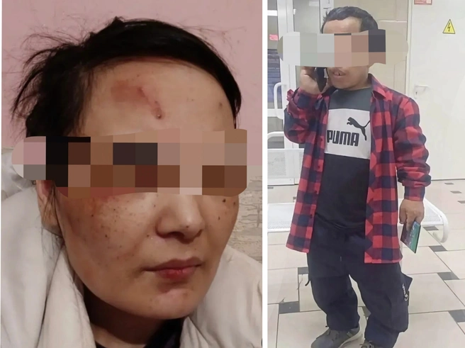 По словам женщины, карлик под угрозой физическрй расправы заставил ее раздеться и сделал откровенные фото, которыми шантажирует ее уже 10 лет | Источник: «mexrinisa1988» / Instagram (экстремистская организация, деятельность запрещена на территории РФ)