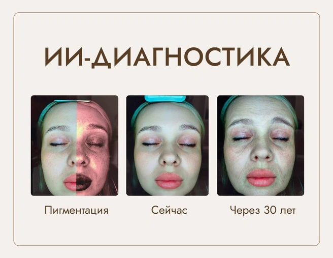 Диагностика помогает «поймать» морщинки, пигментные пятна и другие проблемы на ранней стадии | Источник: Nova Clinic