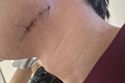 Student assaulted at bus stop in Yakutsk