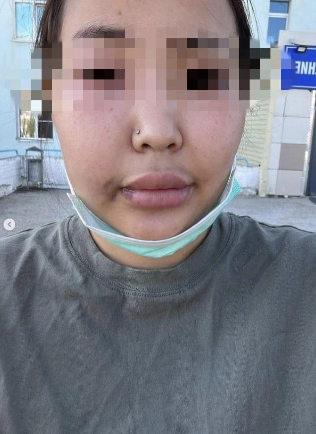 За полтора года унижений девушка привыкла к побоям | Источник: degorova___ / Instagram.com (экстремистская организация, деятельность запрещена на территории РФ)