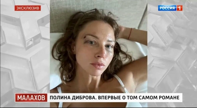 Источник: кадр из телепередачи «Малахов» (16+), телеканал «Россия 1»