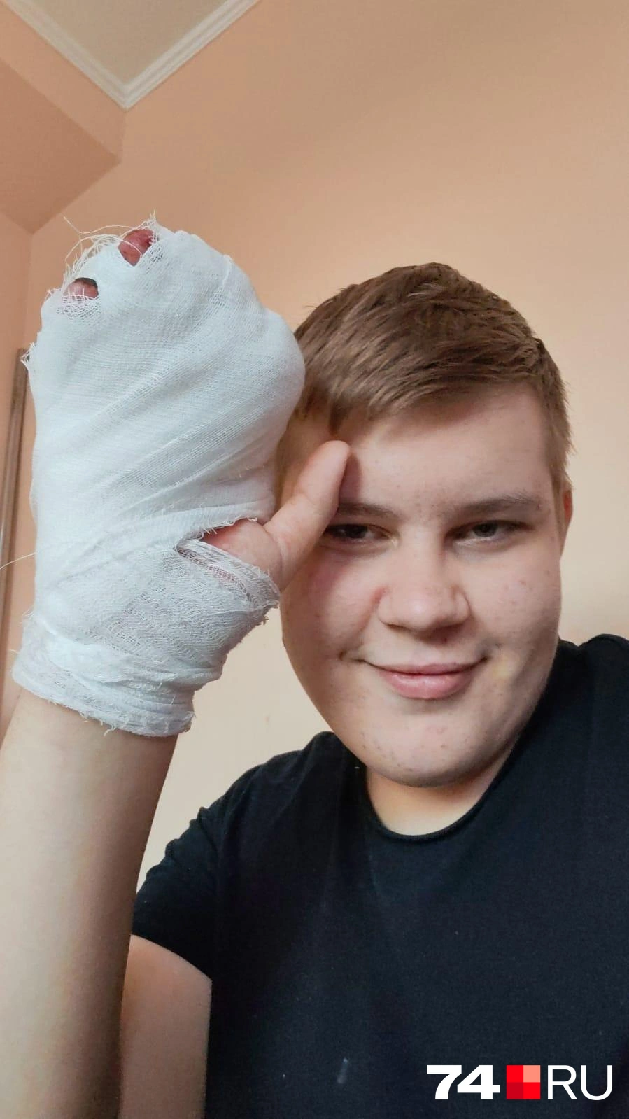 Алексей идет на поправку, но здоровую руку ему уже никто не вернет | Источник: предоставлено Сергеем Касимовым