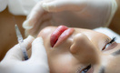 Утиное лицо и усы: 3 вопроса косметологу спасут от этих жутких последствий увеличенных губ
