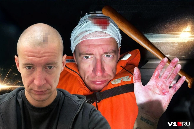 У Василия на голове остался большой шрам от полученных ударов битой | Источник: Полина Авдошина / Городские медиа