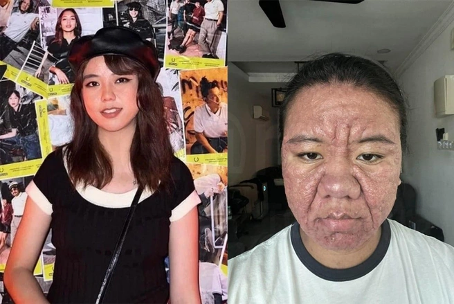 На фото девушка до беременности и после родов | Источник: Oddity Central