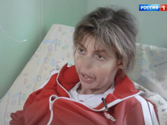 «Потом выскочил фурункул…»: Алиса Казьмина откровенно рассказала, что же случилось с ее лицом