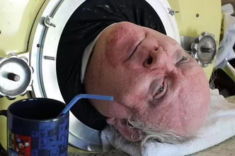Умер человек, проживший 72 года внутри «железного легкого»: каким мир запомнит отважного Пола Александера
