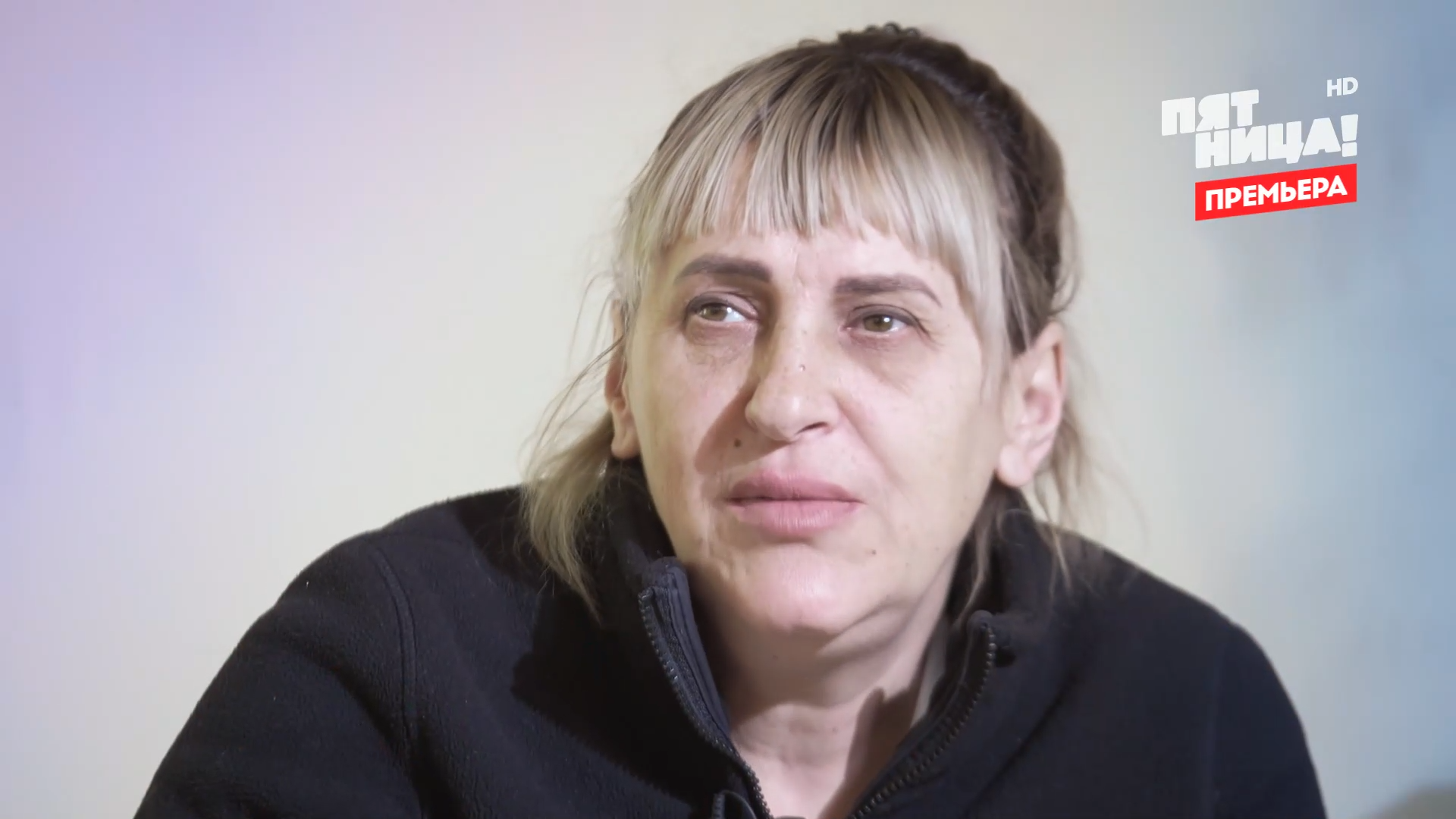 Думала, что это инсульт: лицо россиянки перекосило после введения филлеров