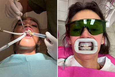 Звезды у зубного врача в их профессиональный день