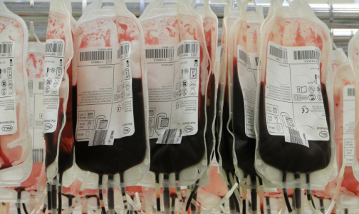 Главный врач Городской станции переливания крови: В случае второй волны проблем с запасами антиковидной плазмы не будет