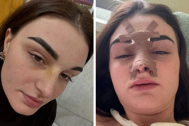 Омичке делали операцию  | Источник: Эльвира Штер