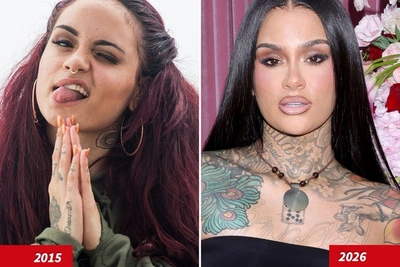 Kehlani: природные данные или пластика?