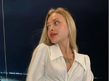Модель Мария Ковальчук лежит с жутким шрамом на лице после зверств в Дубае — кадры из больницы