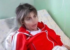 Когда Алиса Аршавина сможет восстановить изуродованное лицо? Разбор хирурга