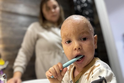 Екатеринбургский мальчик с ихтиозом и его будни