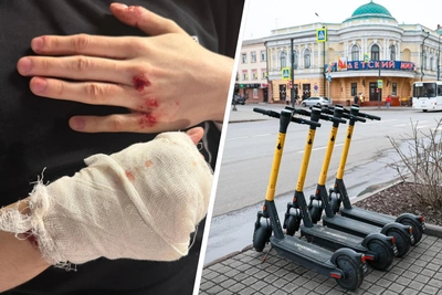Самокатчики лидируют по травмам в красноярских больницах