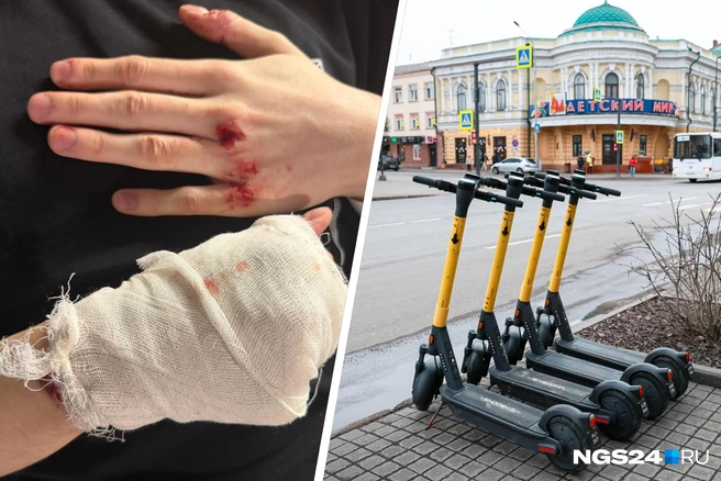 Травма была легкой | Источник: Краевая клиническая больница / Vk.com, Мария Ленц / NGS24.RU