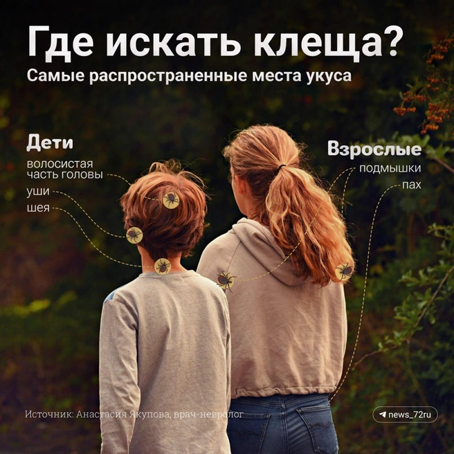 Самые распространенные места укуса клеща | Источник: 72.RU