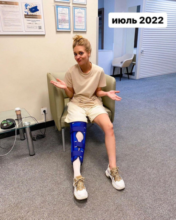 Кристина Асмус сломала ногу и попала в больницу