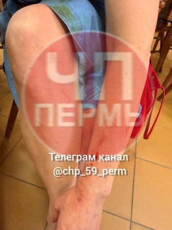 У пермячки остались ссадины | Источник: ЧП Пермь / Telegram
