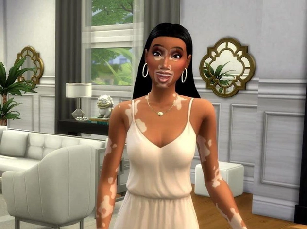 В культовой игре Sims 4 появились персонажи с витилиго
