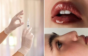 Инвестиции в кожу: 4 трендовые косметологические процедуры — они преобразят любую женщину