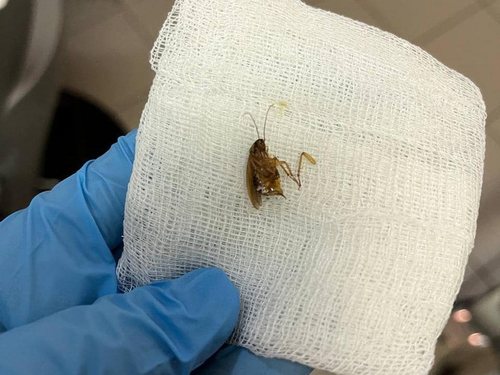 Наделал шума: в ухе у женщины обнаружили живого таракана