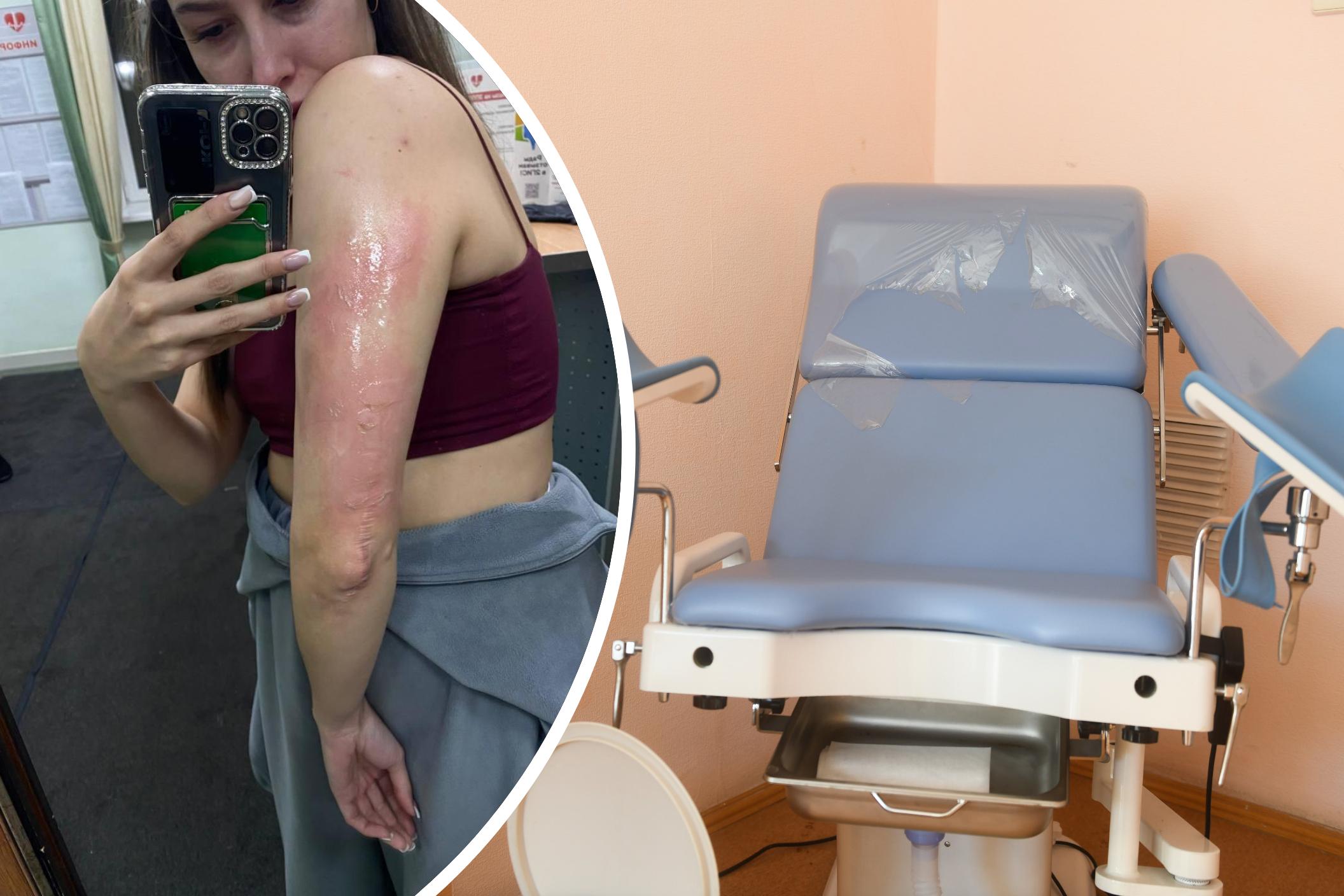 «Оторвали от батареи». Пациентка уральской клиники потеряла сознание на приеме у гинеколога и очнулась с сильным ожогом