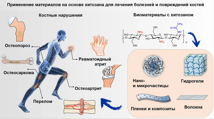 Спасительный панцирь: что такое хитозан и как он стал биополимером будущего