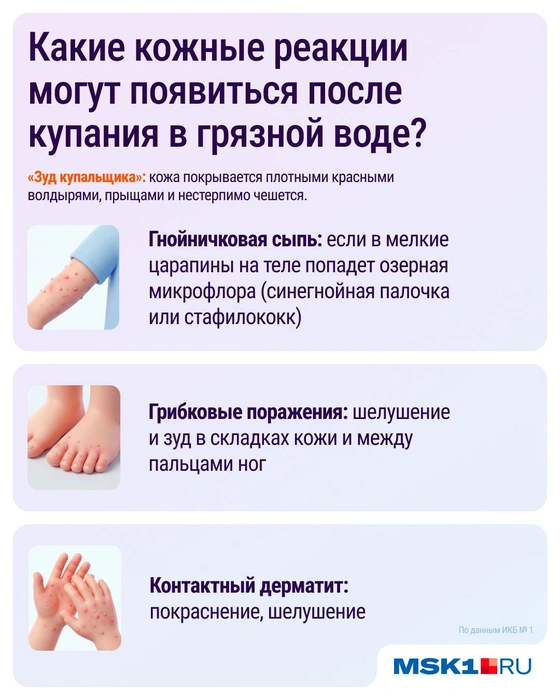 Кожные заболевания | Источник: Серафима Пантыкина / Городские медиа