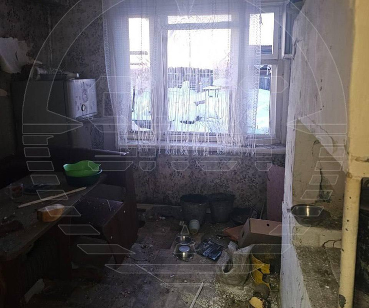 В Иркутской области у школьницы взорвалось зарядное устройство — девочке оторвало кисти рук