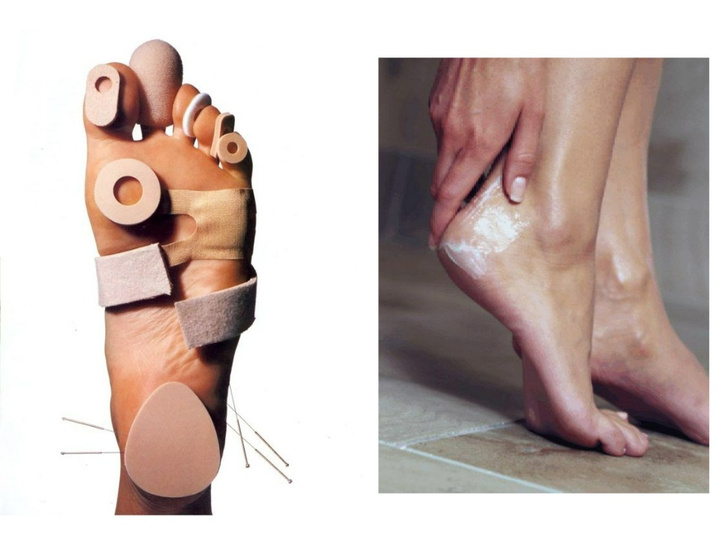 Идеальные ножки: избавляемся от трещин, натоптышей и мозолей дома