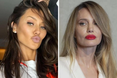 «Пусть напишет мне»: Боня предложила Анджелине Джоли помощь после бьюти-конфуза