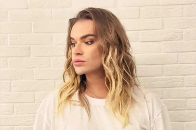 «Вылезли почти все волосы»: Гоген Солнцев судится с салоном красоты из-за ожогов и лысины