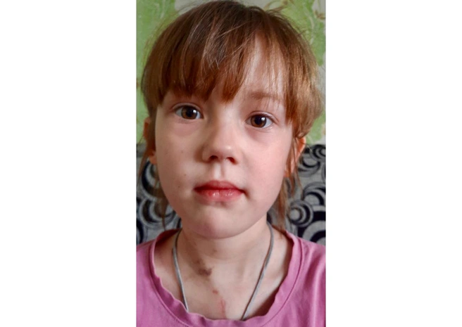 «Собрать средства нужно за три дня». 11-летней Еве срочно нужны лекарства | Источник: семейный архив