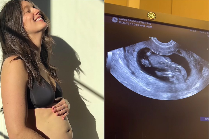Топ-модель Эмили Ди Донато снова беременна