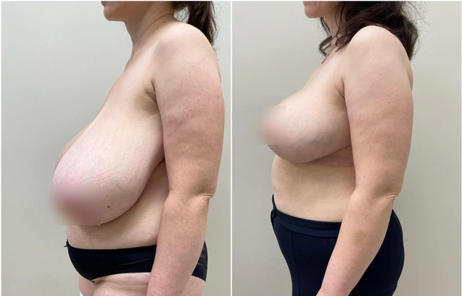 До и после операции (на втором снимке результат спустя 2 месяца) | Источник: Евгений Олейник