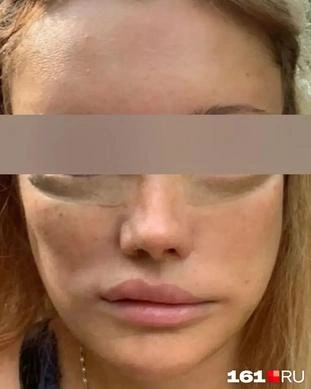 Суд установил только косвенную связь между операцией и состоянием Марии | Источник: юридическая компания «Право на здоровье»