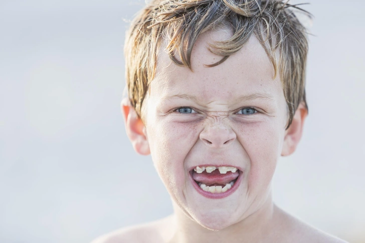 кривые зубы у ребенка | Источник: iStock