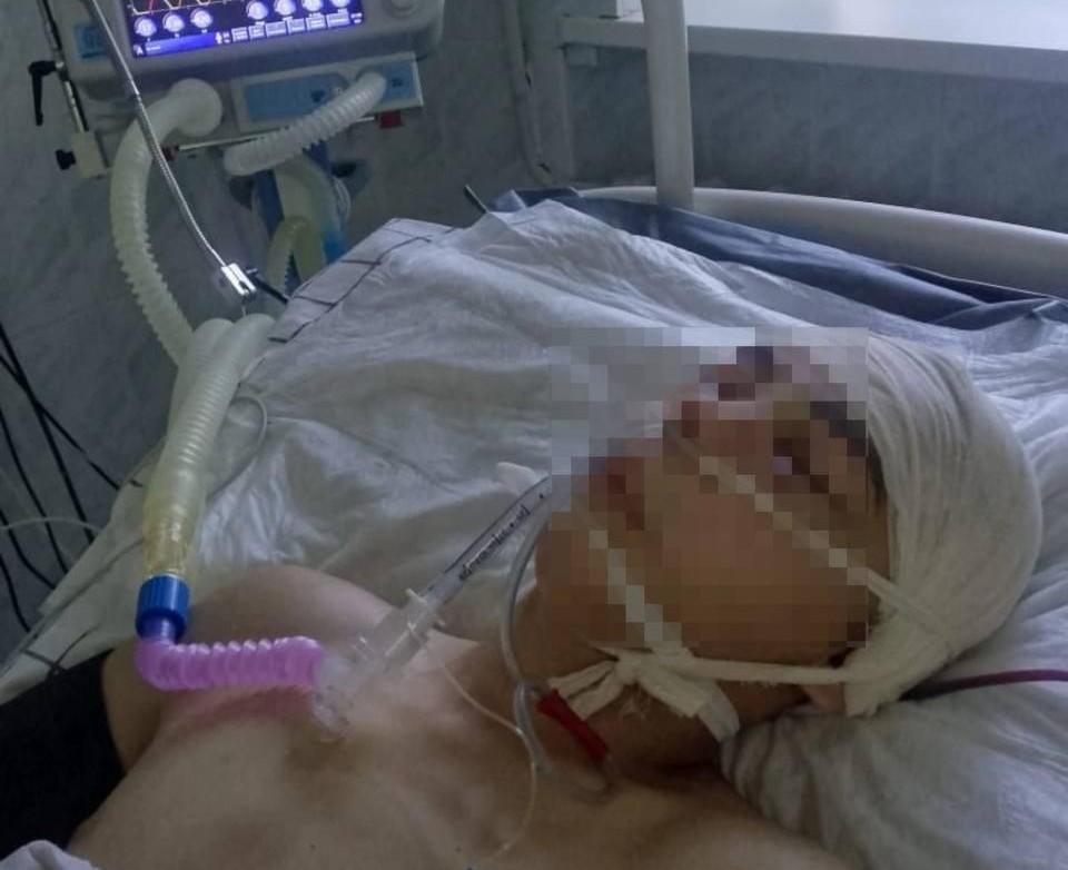 «В коме седьмой день»: в Башкирии мама подростка пожаловалась, что её сына избили до клинической смерти