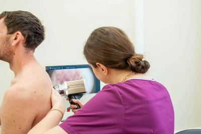 Бесплатная проверка родинок в Красноярске: как пройти