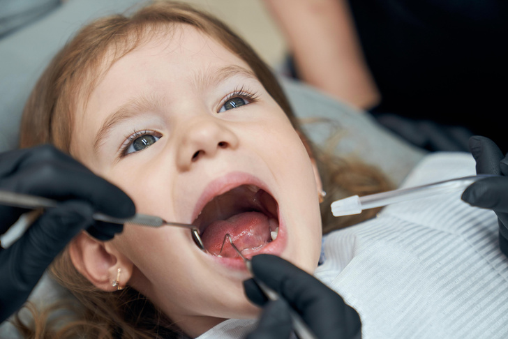 Что делать, если ребенок сломал или выбил молочный зуб