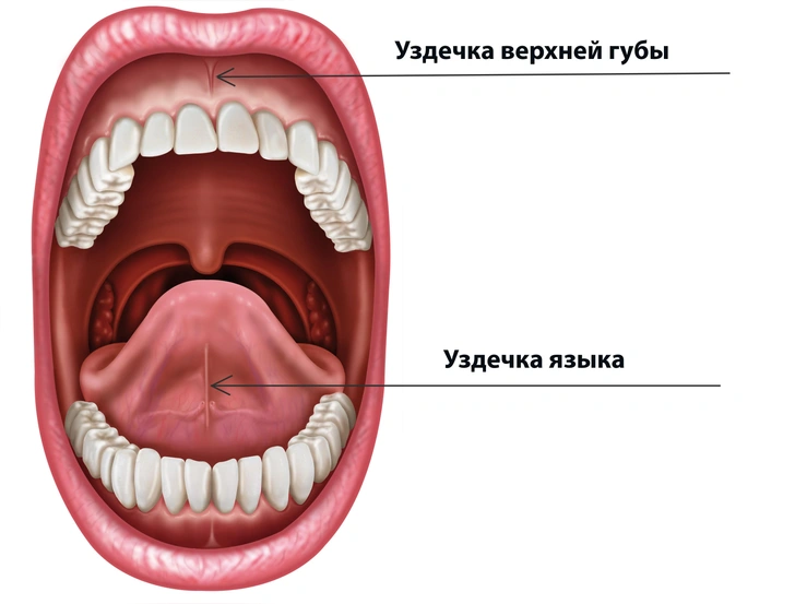 Подрезание уздечки языка у детей: нужно ли делать и какой способ выбрать