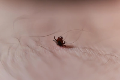 В Томской области ожидается много клещей, но паводок изменит ситуацию