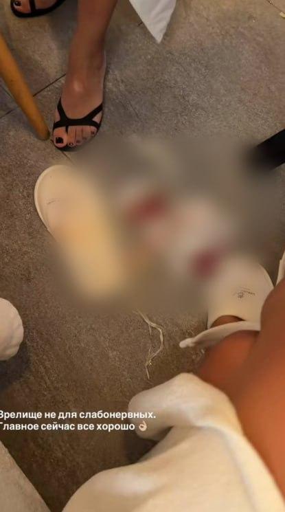 «В ресторане упал потолок». Красотка из Екатеринбурга пострадала во время мощного шторма в Турции —…