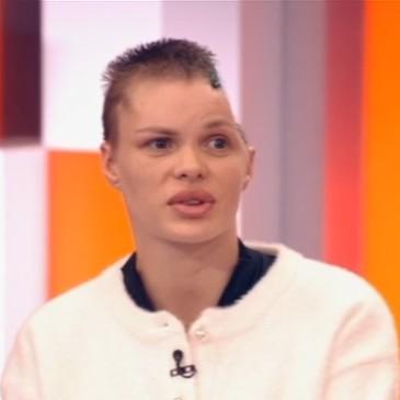 Вернула красоту? Как сейчас выглядит Анжелика Тартанова, которая лишилась полголовы после избиения бойфрендом