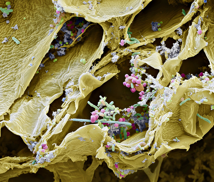 Суть вещей: что можно увидеть, взглянув через микроскоп на квашеную капусту