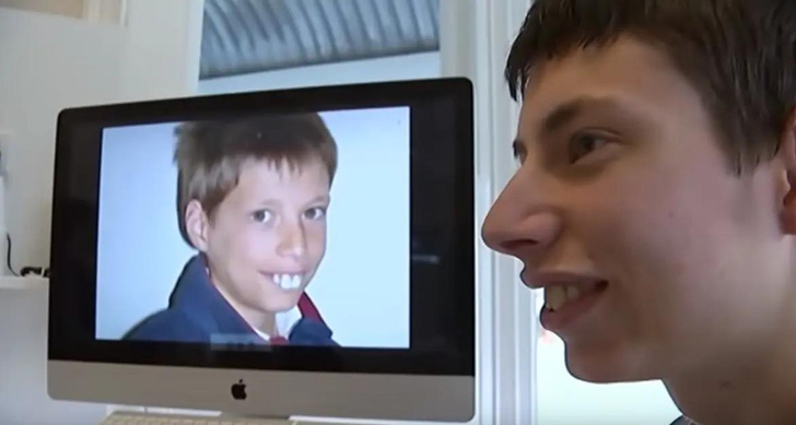 Как выглядит мальчик, который родился с самыми большими зубами в мире — фото