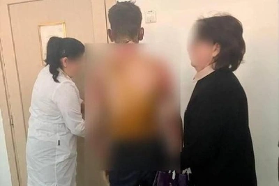 "Not everything depends on us": one of the victims of school arson in Krasnoyarsk will need skin graft